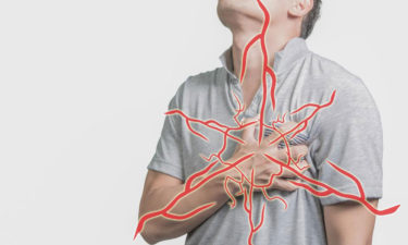 10 heart attack symptoms that are uncommon