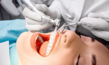 4 Medicare dental plans that cover your dental care