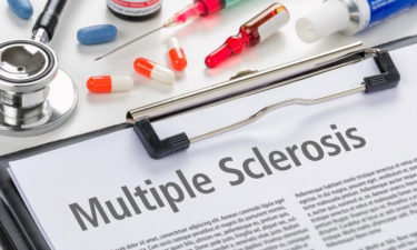 5 common symptoms of multiple sclerosis
