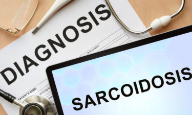 5 tell-tale signs and symptoms of sarcoidosis