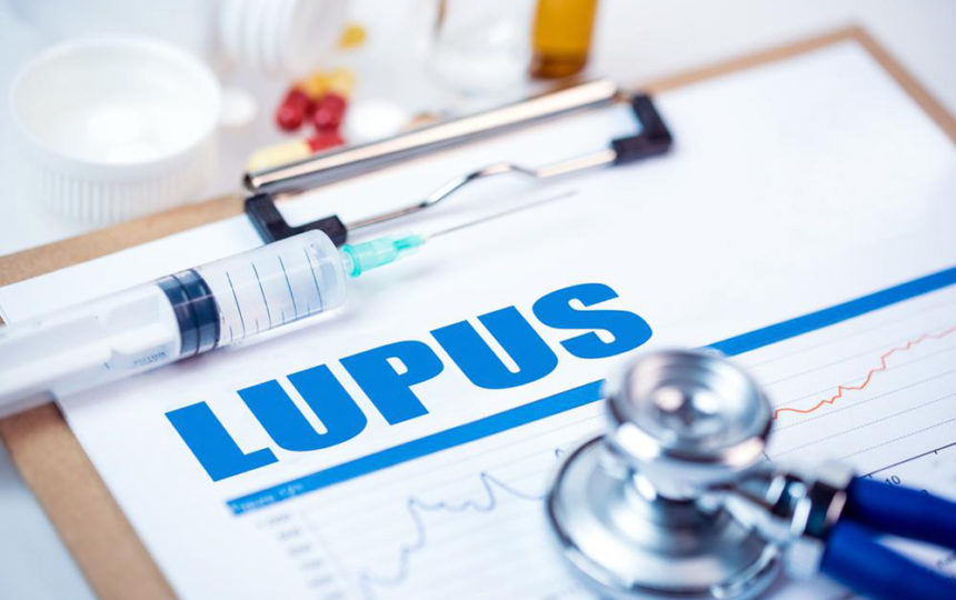 5 things to know about Lupus