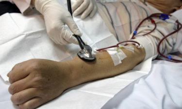 5 useful things a person undergoing kidney dialysis should know