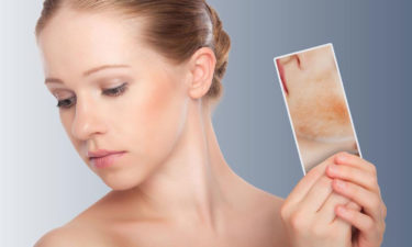 6 things you should not do if you have skin rash