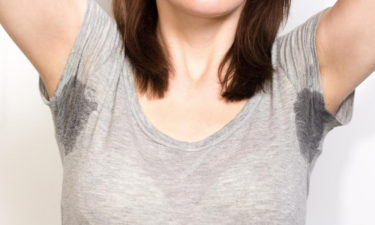 A basic understanding of primary hyperhidrosis