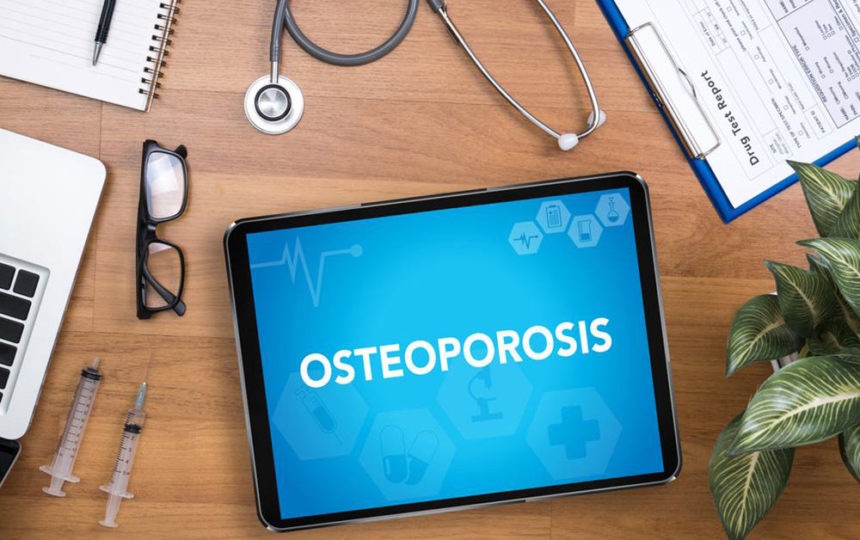 A brief overview of osteoporosis