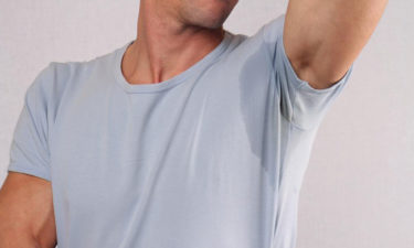 Advanced management of excessive sweating
