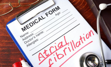 An overview of Atrial Fibrillation