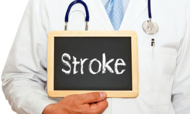 An overview of mini stroke- causes and symptoms explained