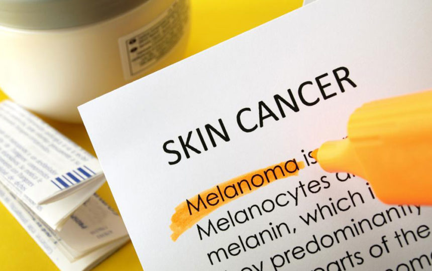 An overview of skin cancer