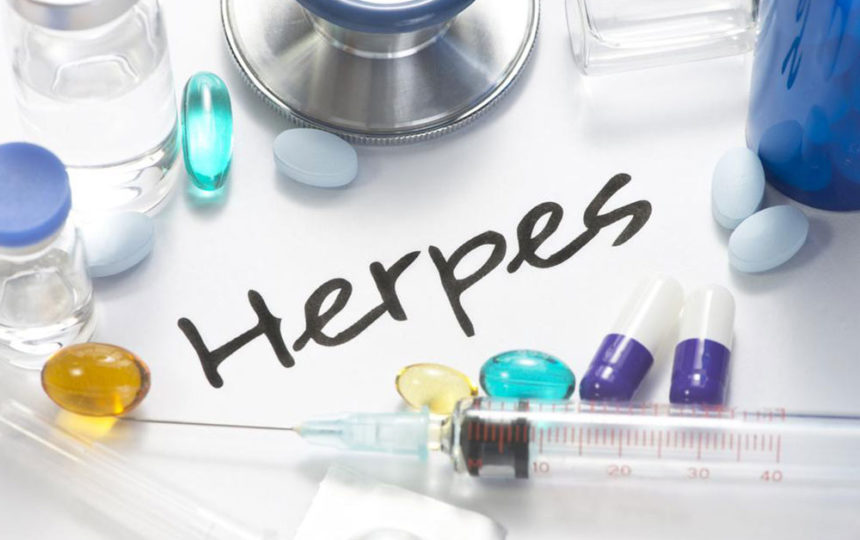 Causes and clinical symptoms of herpes
