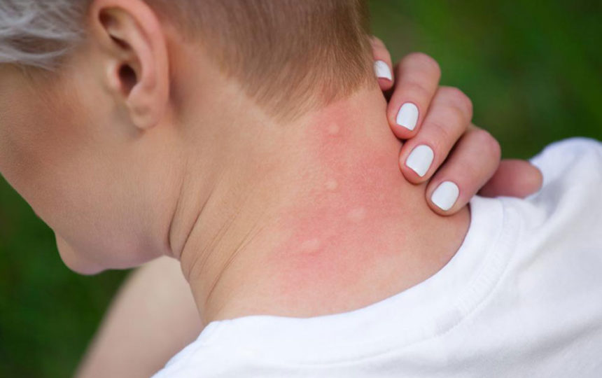 Causes and diagnosis of itchy skin