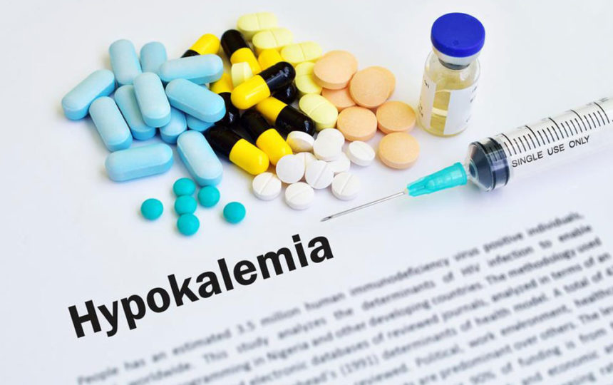 Causes and prevention of Hyperkalemia