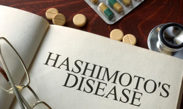 Causes and symptoms of hashimotos disease