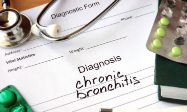 Chronic Bronchitis: An overview