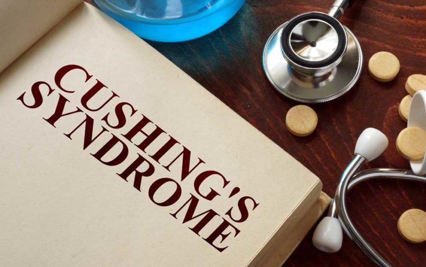 Common Signs and Symptoms of Cushing Syndrome