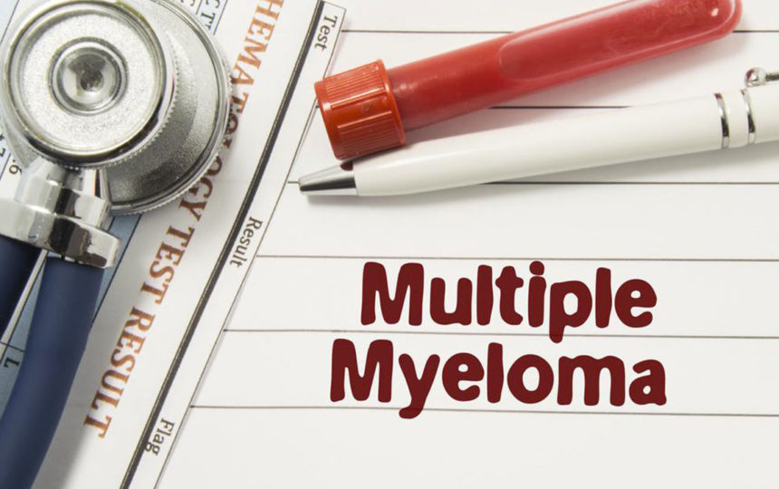 Dealing with multiple myeloma – Things you should know about