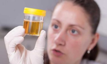 Determining Your Health with a Urine Color Chart