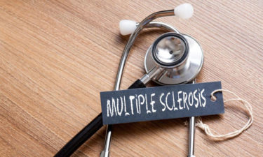 Diagnosis and treatments of multiple sclerosis