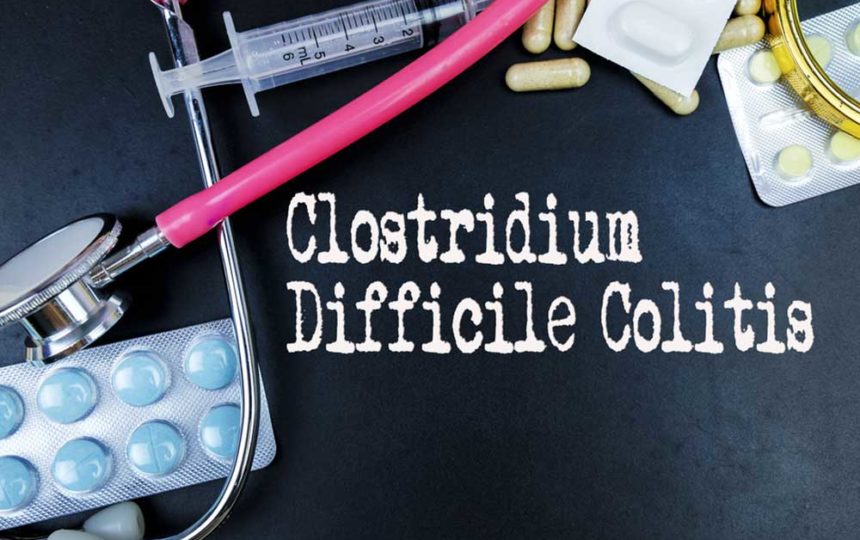Early Symptoms of Clostridium Difficile Colitis