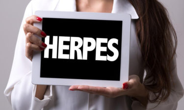 Effective alternative treatments to cure herpes