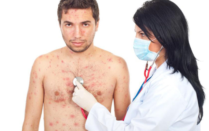 Five forms of health conditions that can be caused due to staphylococcus