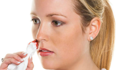 Here are the causes behind nose bleeding