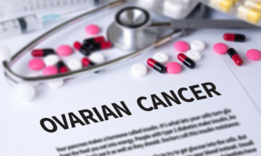 Here’s What You Need to Know about Ovarian Cancer