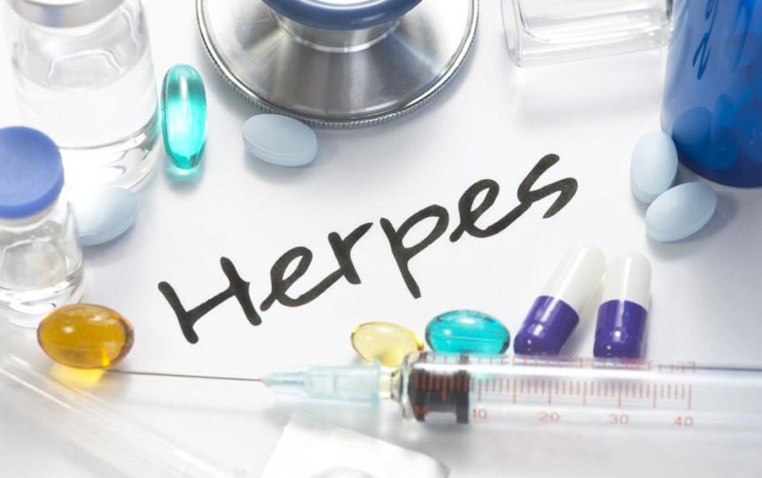 Herpes: Things one should be aware of