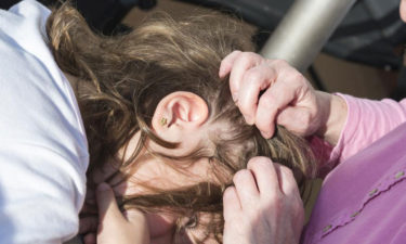 Home remedies for treating head lice