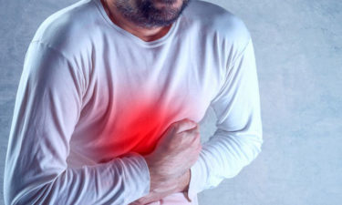 How is esophagitis diagnosed and treated