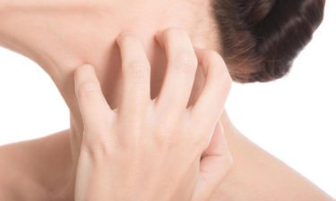 How to treat common skin rashes