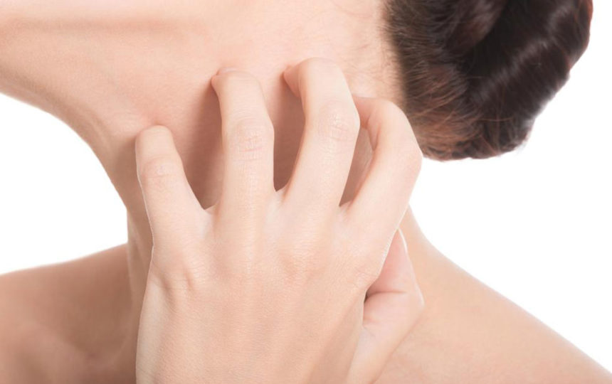 How to treat common skin rashes