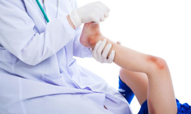 Medical treatment to heal a bruise quickly