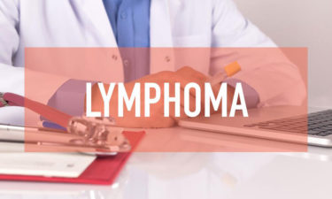 Non Hodgkin Lymphoma treatment – Symptoms, causes and more explained
