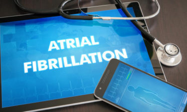 Signs and symptoms of Atrial Fibrillation and how to manage them