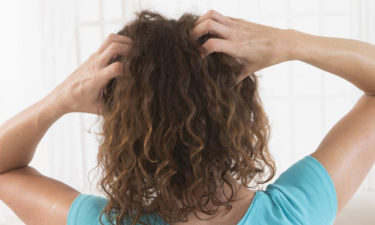 Symptoms and treatment of scalp psoriasis
