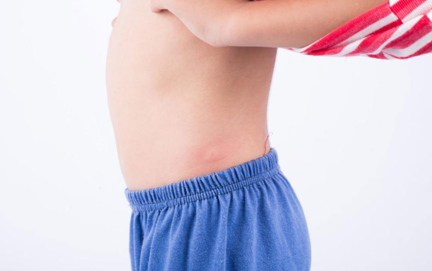 Ten types of skin rashes you should know about