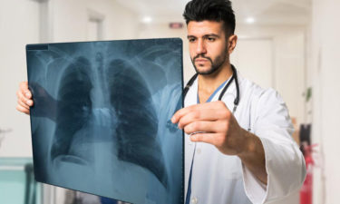 The 3 main signs of lung cancer