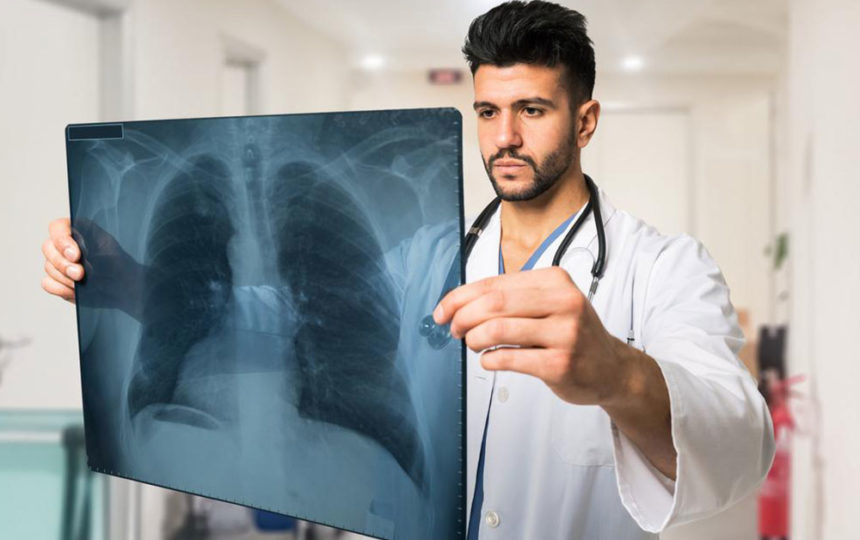 The 3 main signs of lung cancer