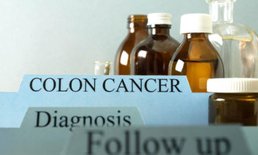 Things you need to know about colon cancer