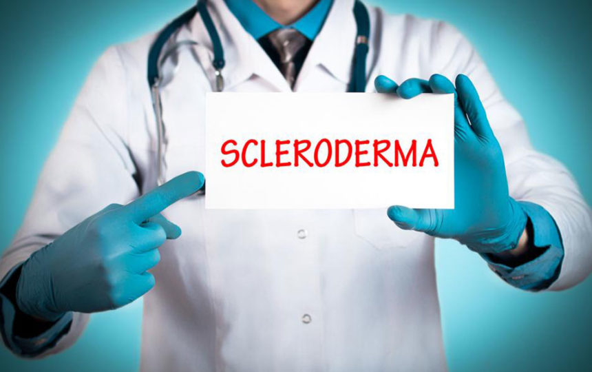 Treating the early symptoms of scleroderma