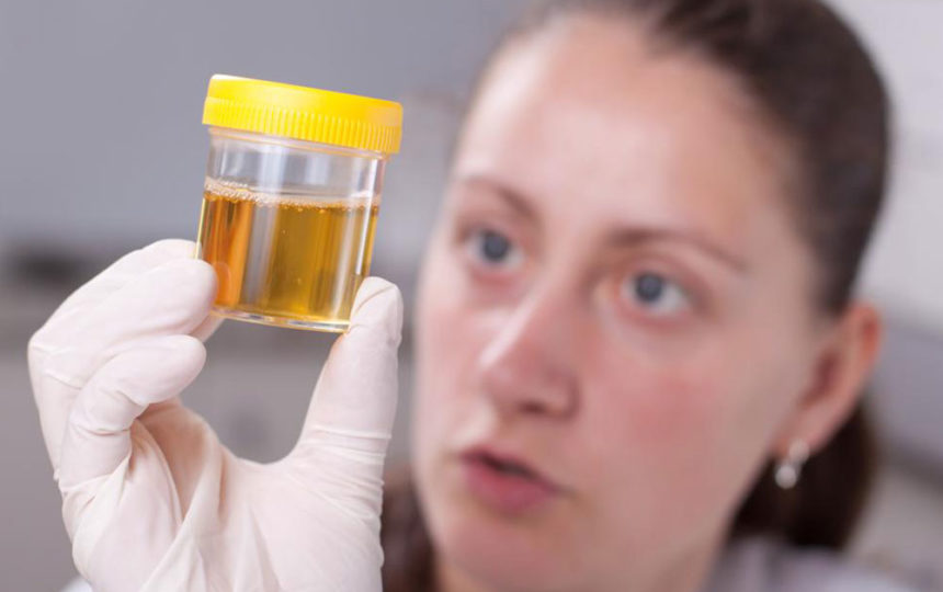 Types of urine colors and what they indicate