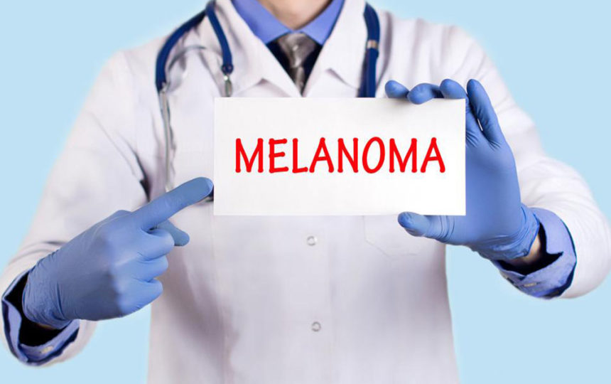 Understanding metastatic malignant melanoma
