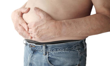 Understanding the causes, symptoms and treatment options for diverticulitis