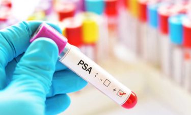 What are the Normal PSA Levels as Per Age