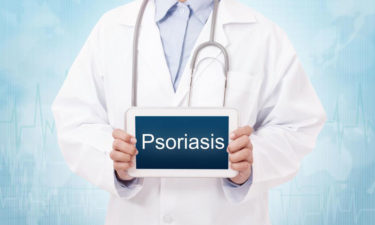 What are the possible plaque psoriasis treatments?