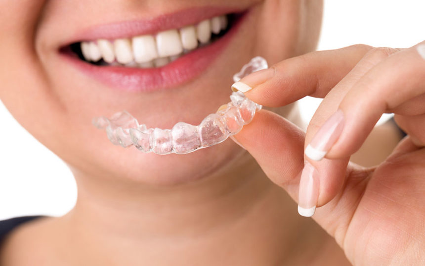 An overview of invisible teeth aligners braces