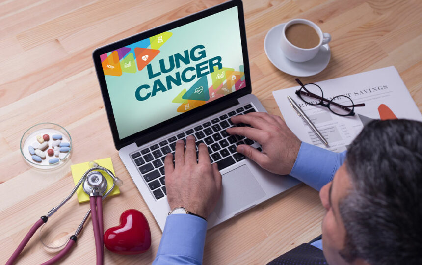 3 tips to manage lung cancer