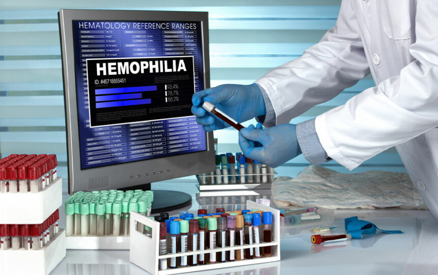 5 ways to live healthy with hemophilia