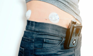 Insulin pumps – 3 best devices to buy in 2021